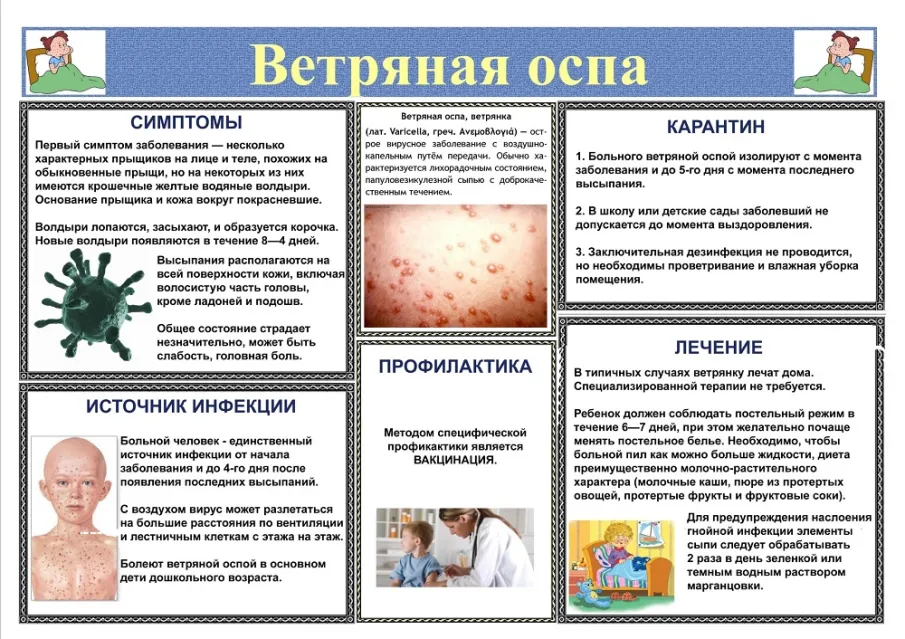 Ветряная оспа (ветрянка): симптомы, диагностика и лечение