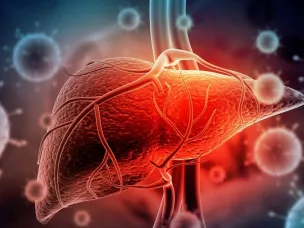 Вирусный гепатит А