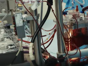 Четырех пациентов с разрывом аорты спасли в Нижегородском кардиоцентре с начала 2026 года