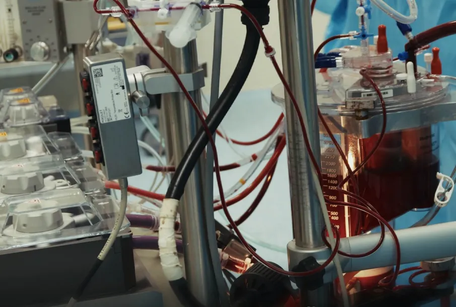 Четырех пациентов с разрывом аорты спасли в Нижегородском кардиоцентре с начала 2026 года